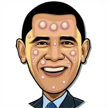 สตาร์บีบสิว