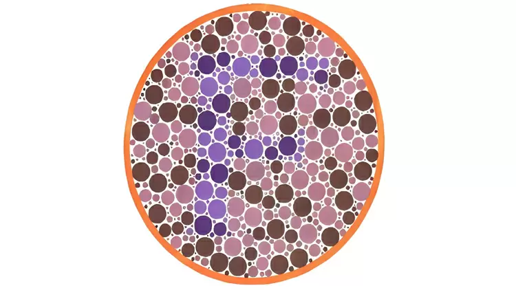 請選擇圖片中的字母。