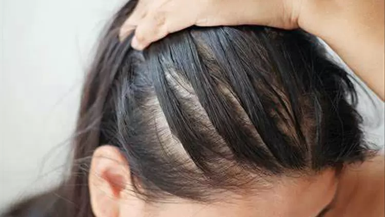 十年後你的頭髮會變稀疏。